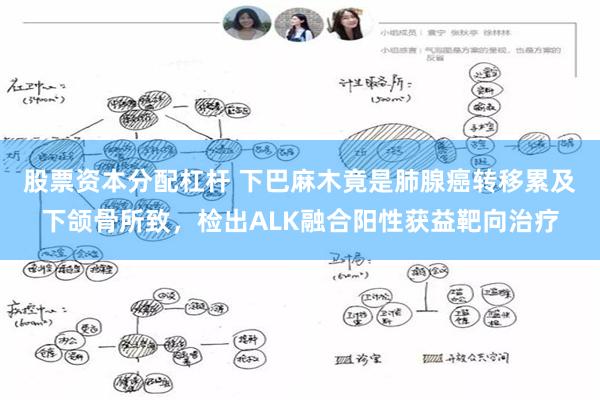 股票资本分配杠杆 下巴麻木竟是肺腺癌转移累及下颌骨所致,检出ALK融合阳性获益靶向治疗